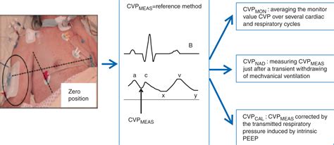 Comparison of different techniques of central venous pressure measurement in mechanically ...