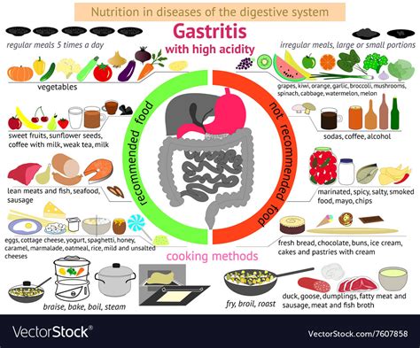 Infographics proper nutrition gastritis Royalty Free Vector