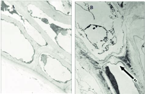 The action of enzymes on the cell walls of grapes' skin-control (A) and... | Download Scientific ...