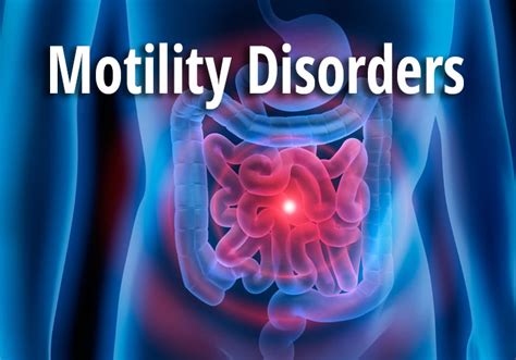 Dumping Syndrome: Updated Perspectives on Etiologies and Diagnosis - Practical Gastro