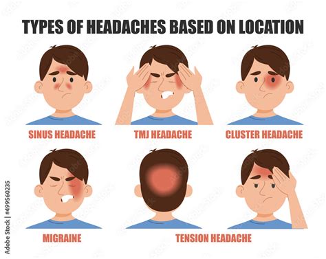 Types of headache based on location vector isolated. Pain in different ...