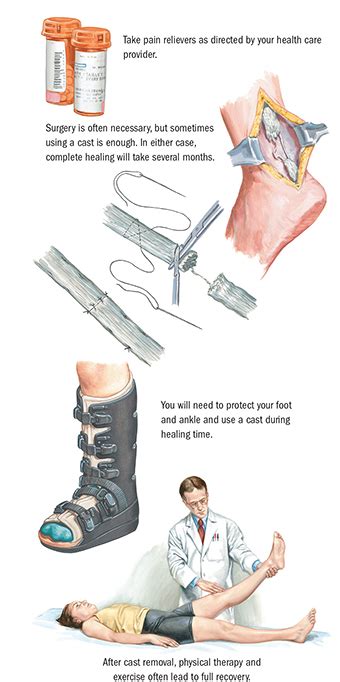 Achilles Tendon Reattachment Surgery | Orthopedic Health | Spectrum Health