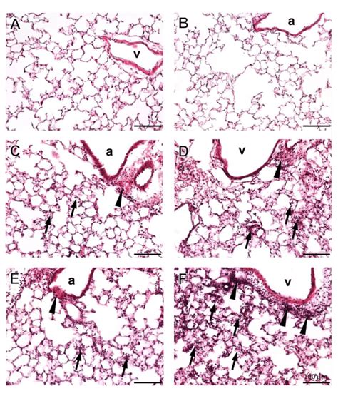 Pulmonary histopathology. Representative micrographs of pulmonary... | Download Scientific Diagram