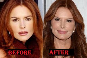 roma downey plastic surgery before and after Archives - Plastic Surgery ...