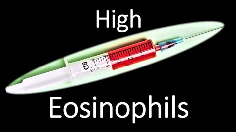 Eosinophil High in blood Test Means , Eosinophils , causes of High ...