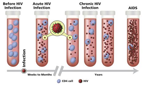 The Stages of HIV Infection | NIH