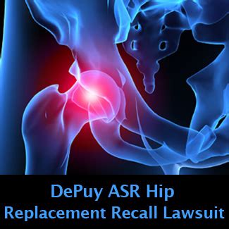 DePuy ASR Hip Replacement Recall Lawyers at Wright & Schulte LLC ...