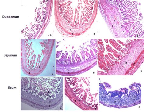 Histology Of Duodenum Jejunum Ileum – NBKomputer