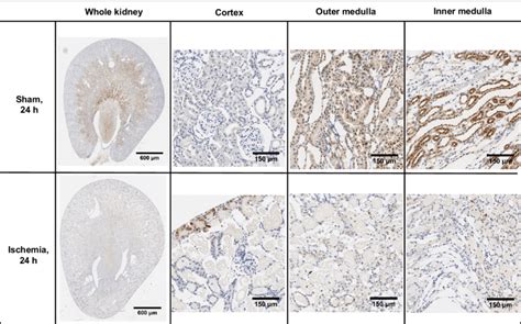 Pimonidazole adduct immunohistochemistry of renal sections 24 h ...