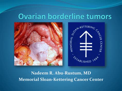 Mucinous Borderline Tumors - obgynkw