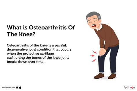 Osteoarthritis Of The Knee: Causes, Symptoms, Treatment and Cost