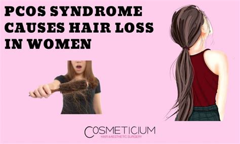 PCOS Syndrome Causes Hair Loss in Women - Cosmeticium