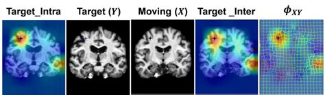 Attention map visualization. | Download Scientific Diagram