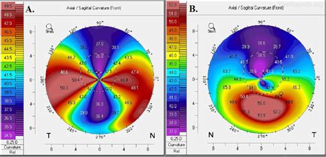 Corneal Imaging: An Introduction