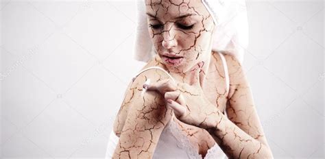 Cracked skin treatment — Stock Photo © EmiliaU #81903088