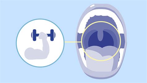 Excercises to Stop Snoring - What Really Works?