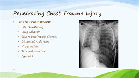 PPT - Thoracic and Abdominal Trauma PowerPoint Presentation - ID:4639236