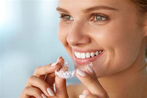 What Does the Invisalign Process Involve? – Totally Dental