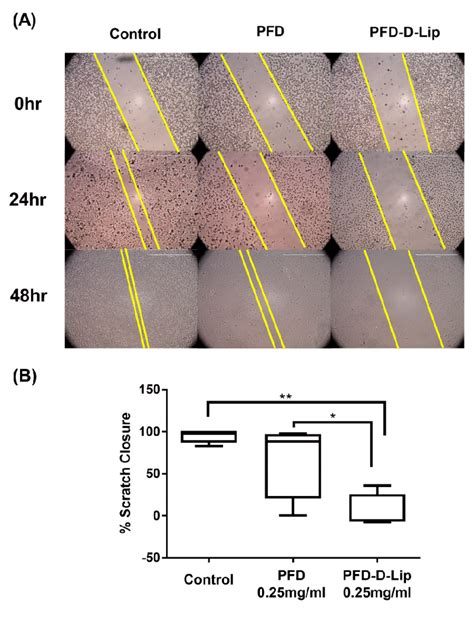 In-vitro scratch wound healing assay with A549 cells treated with PFD... | Download Scientific ...