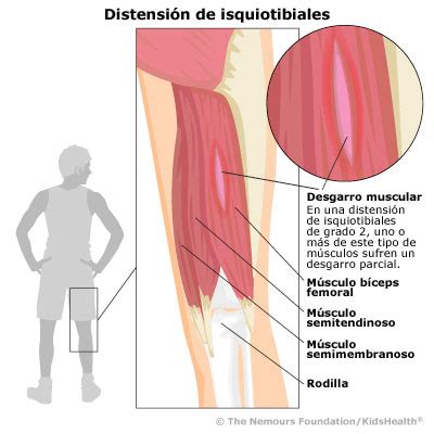 Ya que Volverse Revisión dolor detras de la rodilla al estirarla esta noche Resistente Aproximación