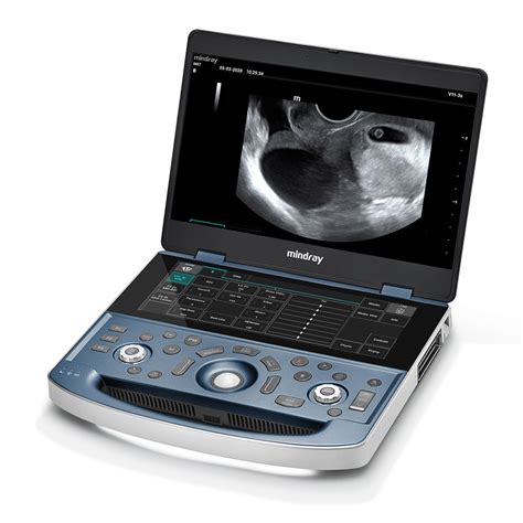 Mindray MX7 Ultrasound OBGYN Package 2 Probes (With Cart)