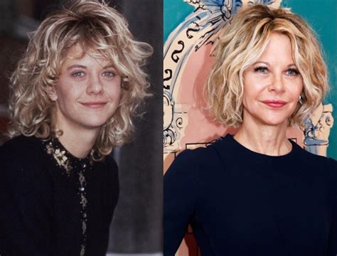 Meg Ryan Before and After Plastic Surgery: Face, Nose, Lips