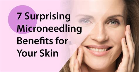 7 Surprising Microneedling Benefits for Your Skin - Camberley Dermapen