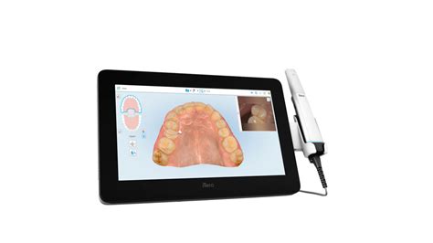 iTero Lumina TM intraoral scanner