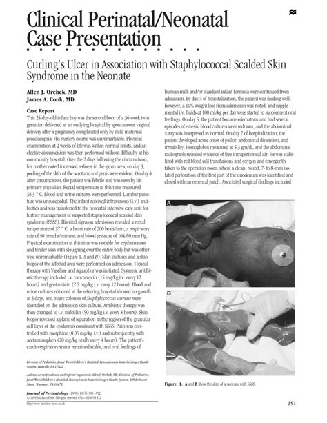 (PDF) Curling's ulcer in association with staphylococcal scalded skin syndrome in the neonate