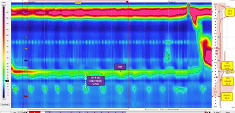 Esophageal manometry study, prep, procedure, results & risks