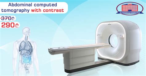 CT Scan Of The Abdomen With Contrast For 290 GEL Instead Of 370 GEL! - National Surgery Center