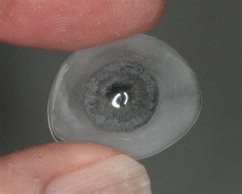 Scleral shells - New Zealand Prosthetic Eye Service