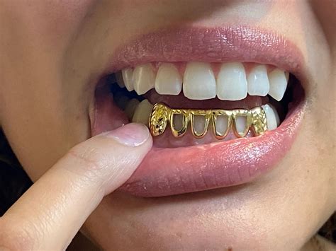 6 10kt Gold Teeth