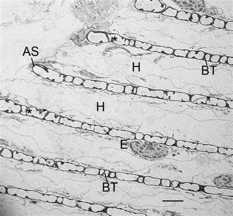 Regular pattern of air sacs (AS) and hemolymph channels (H) that result... | Download High ...