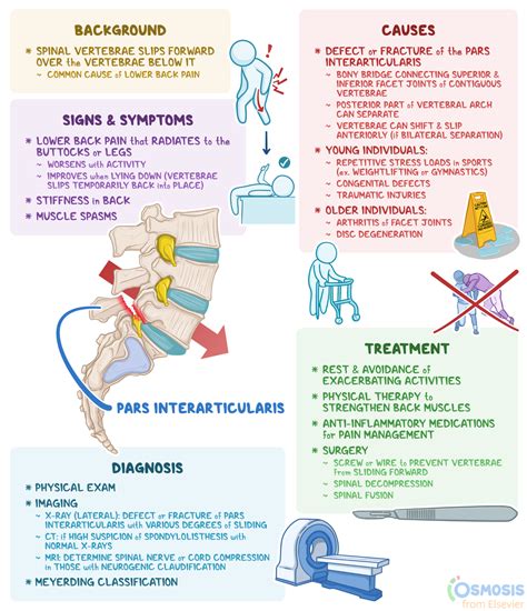 Anterolisthesis: What Is It, Causes, Diagnosis, and More | Osmosis