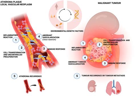 Frontiers | Clinical implications of inflammation in atheroma formation and novel therapies in ...