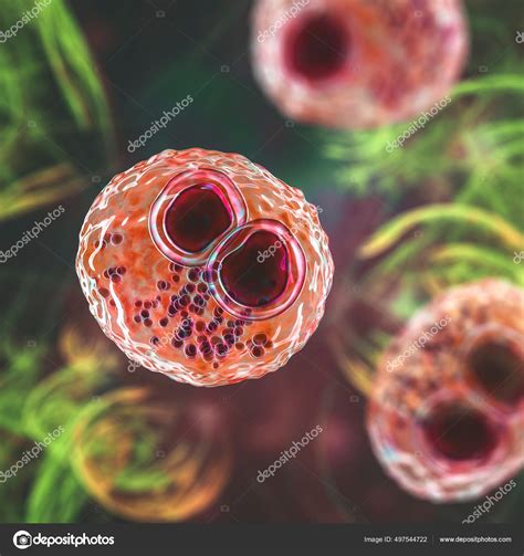 Cytomegalovirus Cmv Human Cell Owl's Eye Inclusion Nucleus Multinucleated Cell Stock Photo by ...