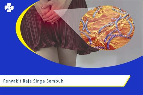 Penyakit Raja Singa Bisa Sembuh Total? | Klinik Utama Sentosa