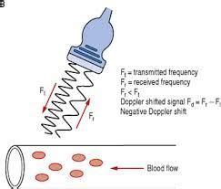 Image result for doppler equation ultrasound | Ultrasound, Ultrasound physics, Sonography