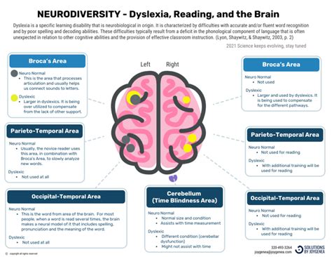 Dyslexia, the brain, and processing reading – Neurodiversity at work ...