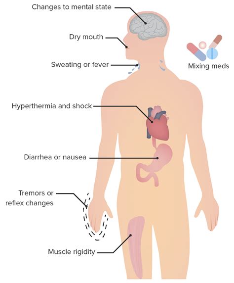 Serotonin Syndrome | Concise Medical Knowledge