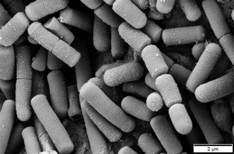 Bacillus cereus - Microbiology - Medbullets Step 1