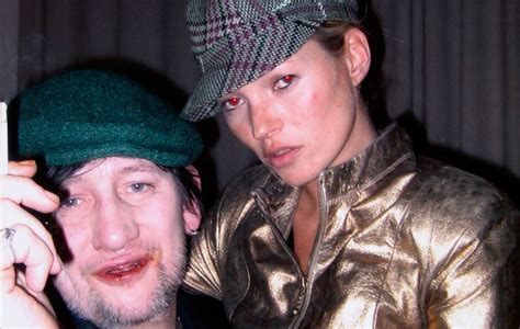 Shane MacGowan announces new art book, 'The Eternal Buzz And The Crock Of Gold'