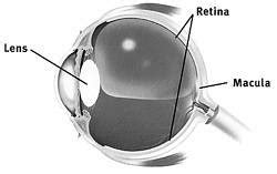 Vitrectomy Surgery | Macular Hole | Vitrectomy Recovery Solutions