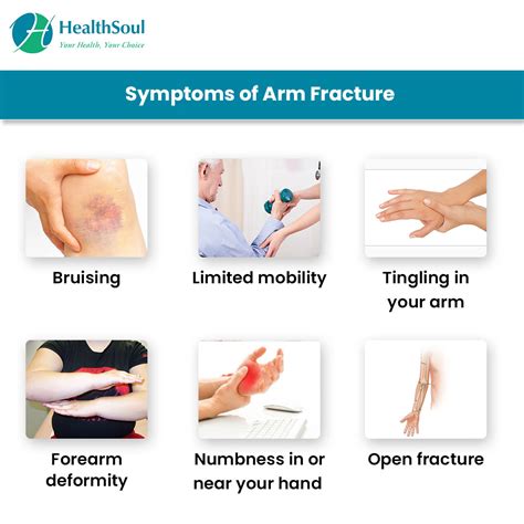 Arm Fracture: Causes and Treatment – Healthsoul