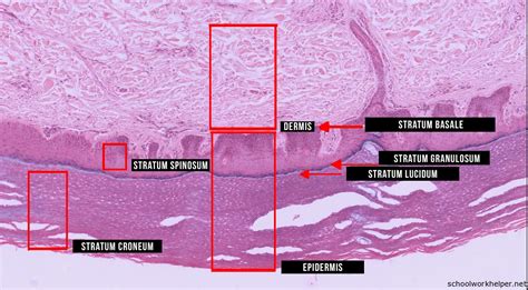 epidermis-slide-labelled-histology | SchoolWorkHelper