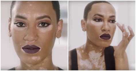 Amy Deanna is Covergirl’s First Model With Vitiligo | Teen Vogue