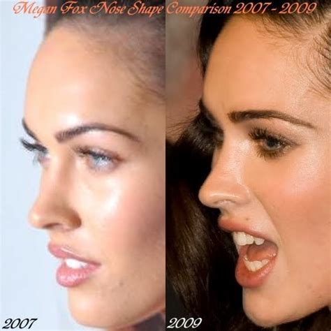 Look At Her Beautiful Face: Megan Fox Nose Shape 2007-2009 Comparison, Does She Have To Do A ...