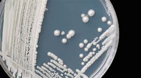 Candida Auris: A drug-resistant fungal infection emerges in US for the ...