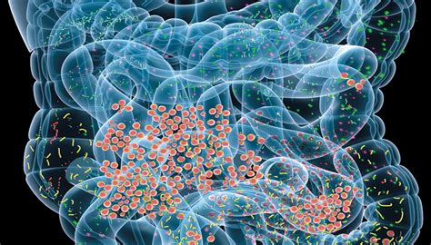 CE: Health and the Human Microbiome: A Primer for Nurses : AJN The ...